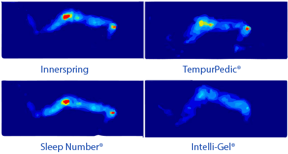 intelli-GEL Reduces Pressure