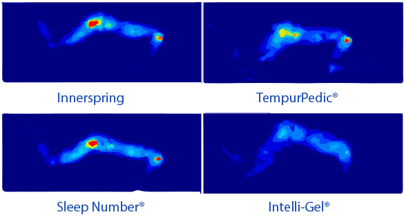 intelli-GEL Reduces Pressure